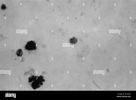 Microfotografía Del Parásito De La Malaria Plasmodium Malariae En Trofozoitos Fase Con