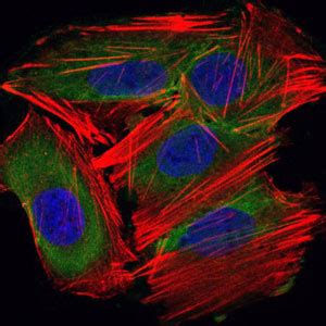 UBE2I Antibody Purified Mouse Monoclonal Antibody WB IHC FC ICC E