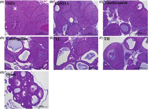 Histological Findings In Ovarian Sections Stained With Masson S