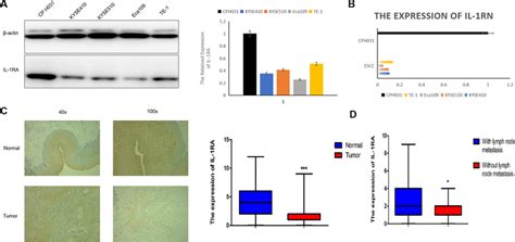 Expression Of IL 1RA In ESCC A IL 1RA Protein Levels In ESCC Cell