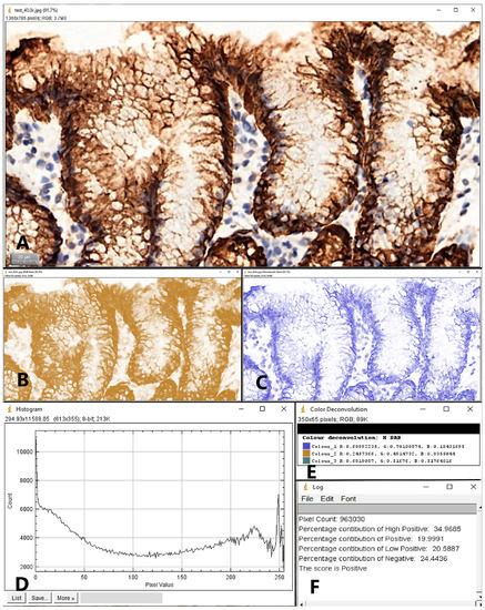 Jcm Free Full Text Helicobacter Pylori Infection And The Patterns