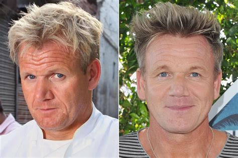 Gordon Ramsay Plastic Surgery: A Close Look Before and After