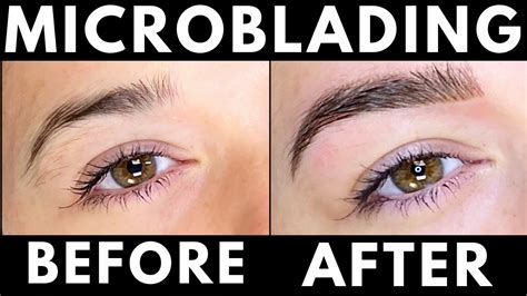 Microblading Experience Before And After Healing Process Day By Day