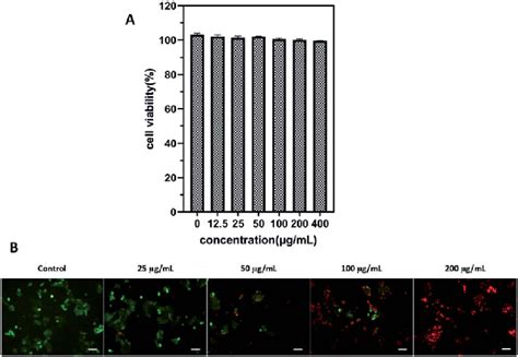 A Cell Viability Of 4t1 Cells After Incubation With Icg Iba Rgd Hsa