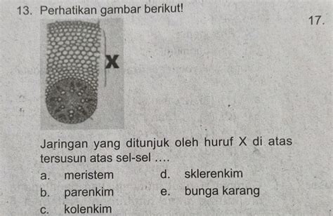 Perhatikan Gambar Berikut Jaringan Yang Studyx