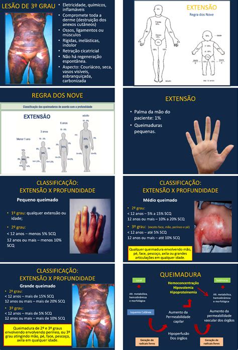 Aula Fisioterapia Em Queimados Fisioterapia Dermatofuncional