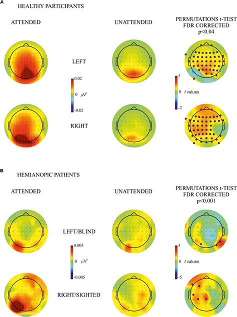 Frontiers Neural Correlates Of Visuospatial Attention To Unseen