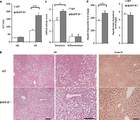 Liver Steatosis In High Fat Diet Hfd Fed B Cell Activating Factor