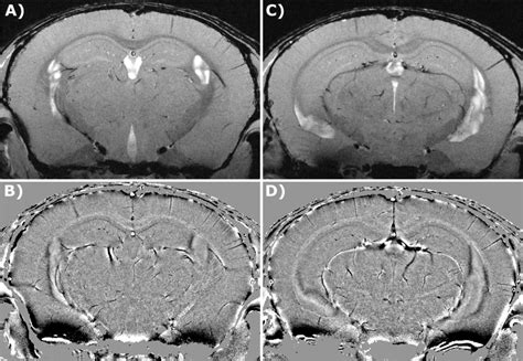 Ultra High Field Magnetic Resonance Imaging Bruker