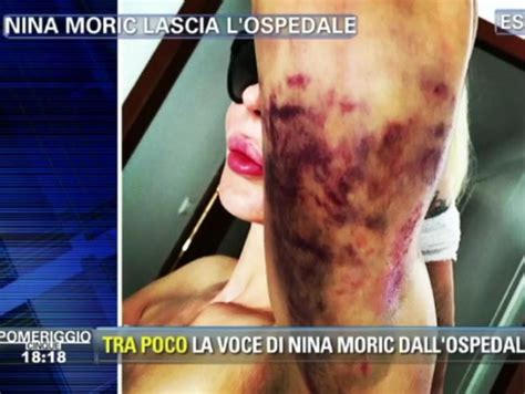 Nina Moric Non Ho Tentato Il Suicidio E L Amico In Tv Attacca Il