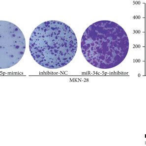 Mir C P Inhibits The Proliferation Migration And Invasion Of Gc