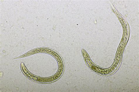 Threadworm Strongyloides In Humans