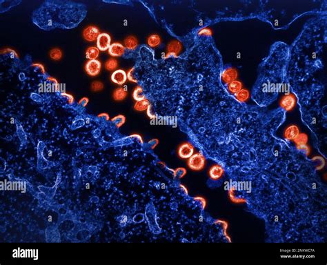 Hiv Particles Budding From Cell Tem Stock Photo Alamy