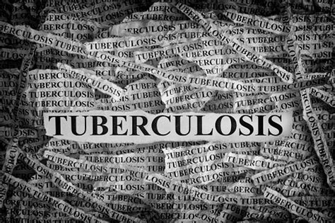 Tuberkulosis Potongan Kertas Robek Dengan Kata Tuberkulosis Foto Stok