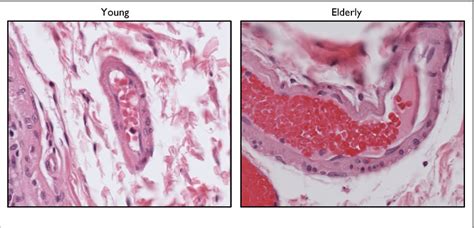 Endothelial Cells