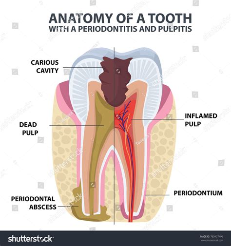 Tooth Anatomy Vector Dental Infographics Enamel 스톡 벡터 로열티 프리 763407496