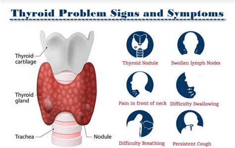 Thyroid Nodule Treatment What To Do