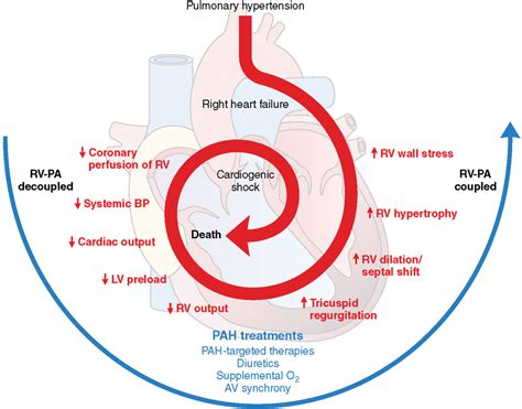 Evaluation And Management Of Pulmonary Hypertension In Noncardiac