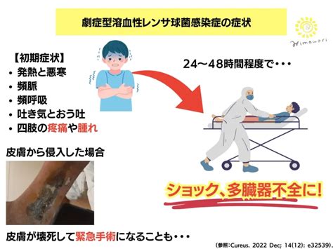 「人食いバクテリア」劇症型溶血性レンサ球菌感染症について【感染経路・症状・予防策】 ひまわり医院（内科・皮膚科）