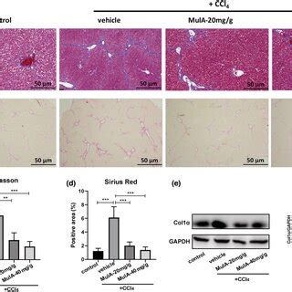 Mulberroside A Alleviates CCl4induced Liver Injury In Mice A