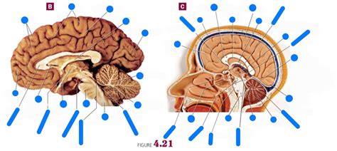 Lab 9 The Brain Midsagittal Cut 3 And 4 Diagram Quizlet