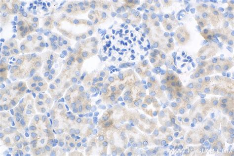 Stx17 Antibody 81899 1 Rr Proteintech 武汉三鹰生物技术有限公司