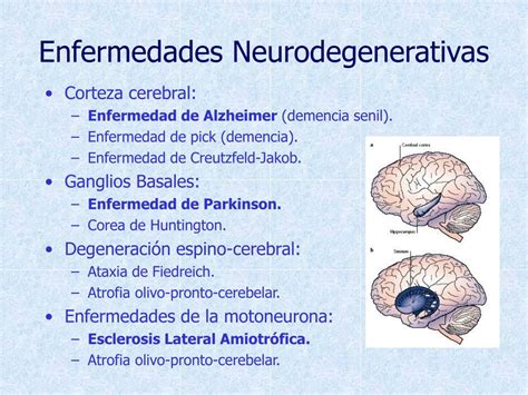 Ppt Apoptosis En Enfermedades Neurodegenerativas Powerpoint