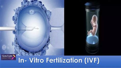 Ppt In Vitro Fertilization Ivf Powerpoint Presentation Free