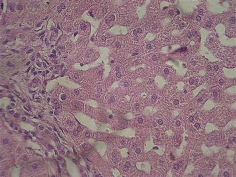 Histopathological Sections Of Rabbits Liver In Group B At 15 Days Post