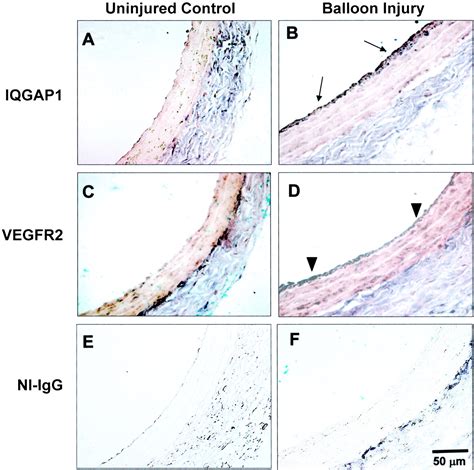 Iqgap A Novel Vascular Endothelial Growth Factor Receptor Binding