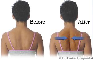 Shoulder blade squeeze | Neuromuscular Spine and Joint Center