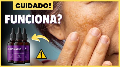 Reative Skin Funciona Ou Fraude Alerta Informa Es Importantes