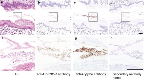 Immunohistochemistry Of Gastric Mucosa From A Representative Patient