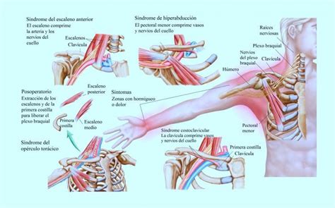 Dolor En El Brazo Izquierdo Derecho Causas Muscular Mujer Y Hombro