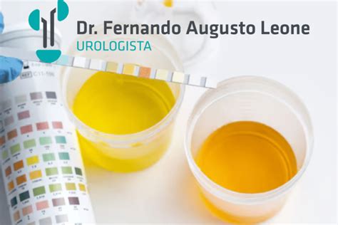 Ureaplasma Parvum Sintomas Diagn Stico E Tratamento Dr Fernando