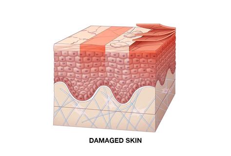 How To Repair A Damaged Skin Barrier Function Kiehl S Uk