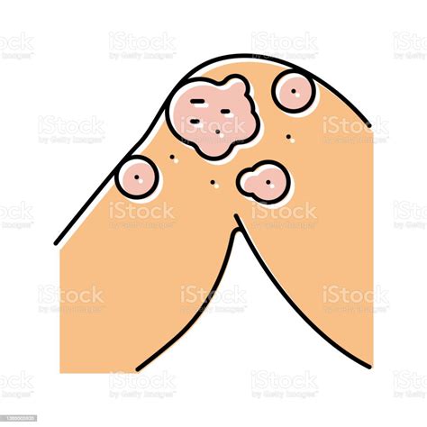 Atopic Dermatitis Color Icon Vector Illustration Stock Illustration