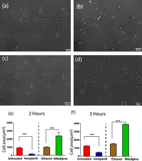 Cell Spreading Kinetics Of Mcf 7 Cells A Phase Contrast Image Of Download Scientific Diagram