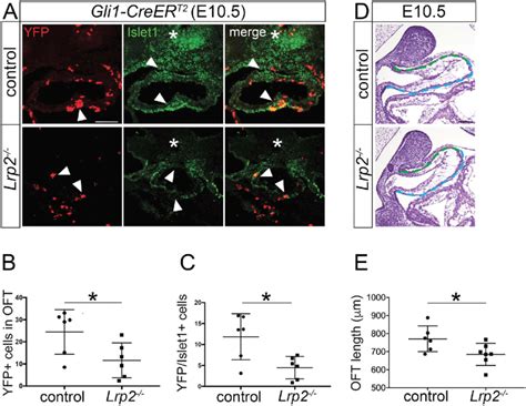 Reduced Shh Responsiveness Of Cardiac Progenitor Cells In The Lrp