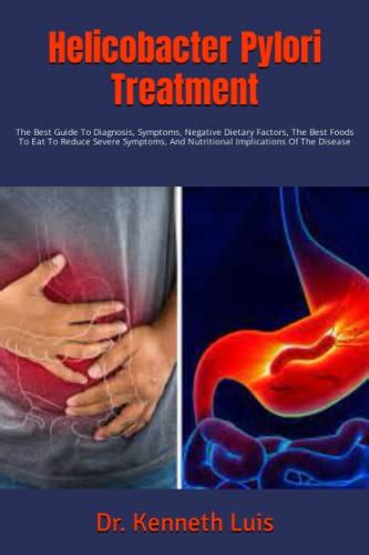 Helicobacter Pylori Treatment: The Best Guide To Diagnosis, Symptoms ...