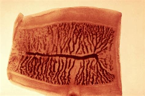 Pdf Gravid Proglottid From The Cestode Taenia Saginata