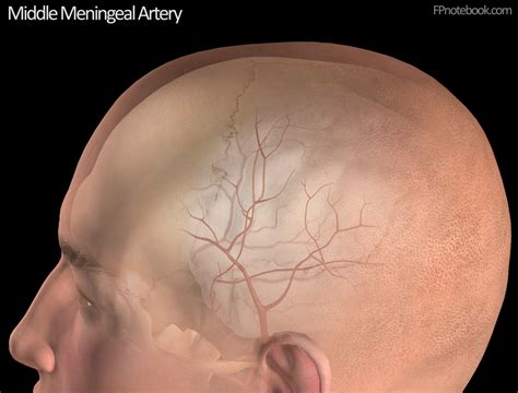 Epidural Hematoma Middle Meningeal Artery