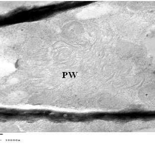 Magnified Electron Micrograph Of Ultrathin Section Of Cell Of Infected