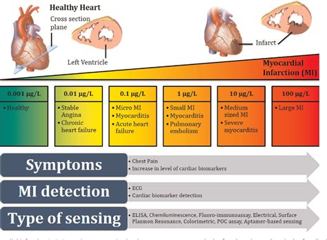 Figure 1 From Diagnostics On Acute Myocardial Infarction Cardiac