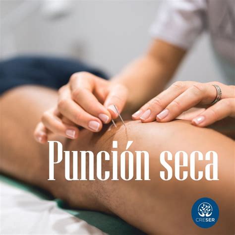 SESIÓN DE PUNCIÓN SECA Kinesiología Fisioterapia