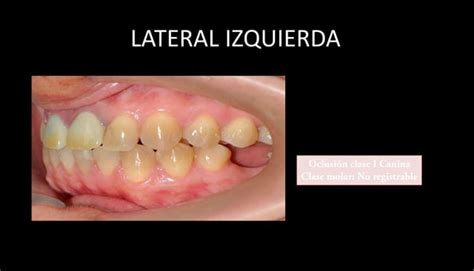 Presentaci N De Casos Cl Nicos De Periodoncia E Implantolog A Oral