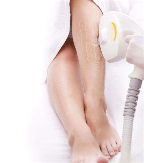 Velashape III For Body Contouring At Dermatech Polyclinic Cellulite