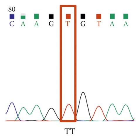 Chromatogram Showing The Rs4846049 Polymorphism In The Download Scientific Diagram