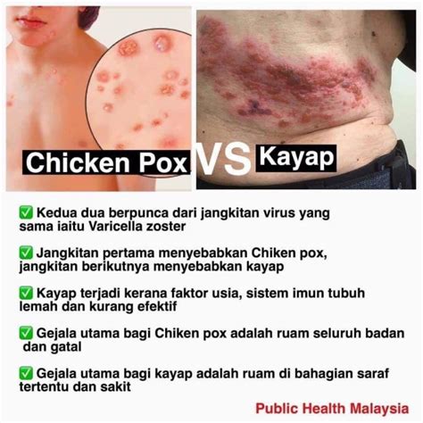 Katanya Kayap Ular Yang Bersambung Boleh Jadi Punca Kematian Doktor