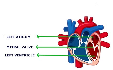 Mitral Valve Stenosis: A Comprehensive Guide to the Causes, Symptoms ...